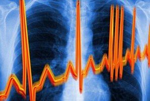 aritmie cardiacă pentru osteochondroză